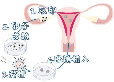 明远生殖医学中心